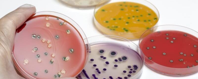 Analisis Listeria en Alimentos
