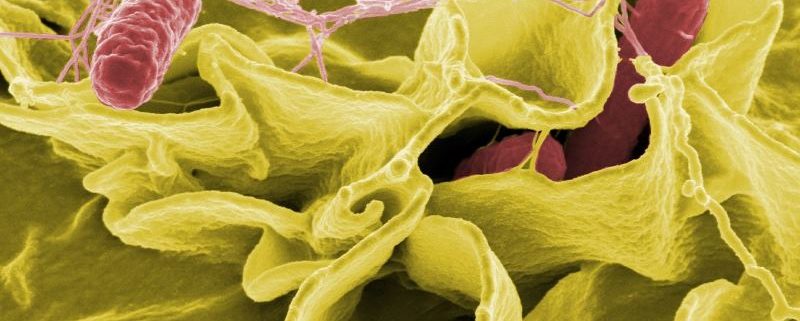 deteccion-analisis-salmonelosis-listeriosis-e-coli-alimentos
