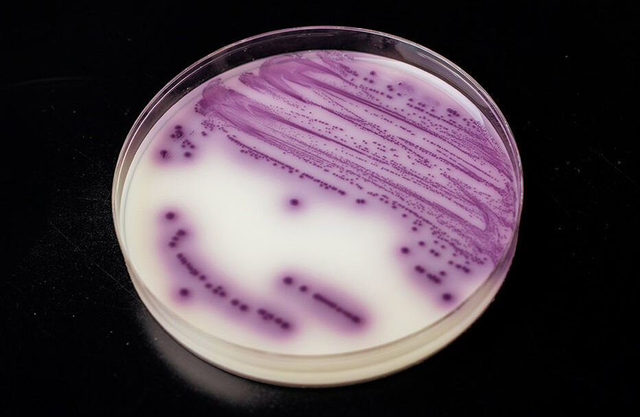 laboratorio analisis de superficies